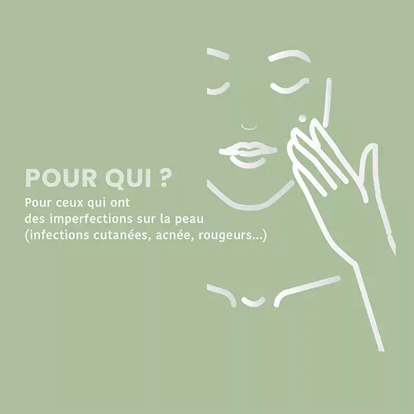 Tratamento Roll-On Orgânico SOS para Imperfeições Santarome com Óleos Essenciais Orgânicos 10 ml