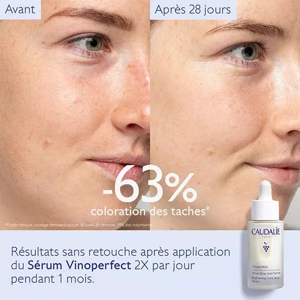 Sérum Anti-Manchas Escuras Vinoperfect Radiance da Caudalie 30ml