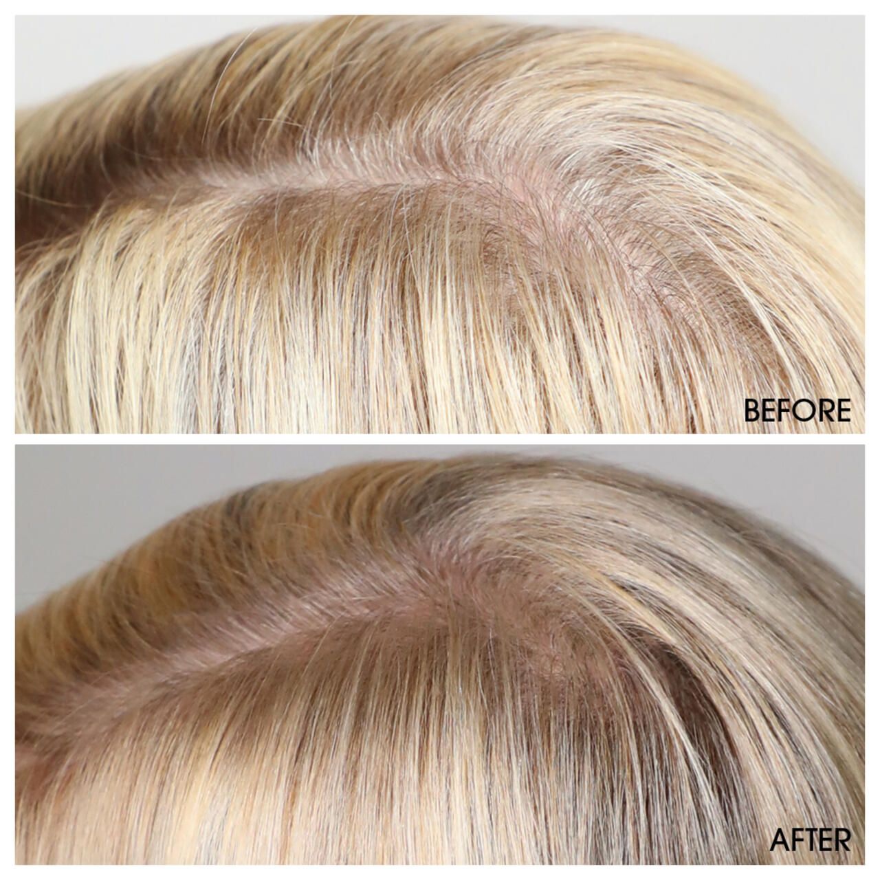 M2 Beaute M2 Hair Activating Serum