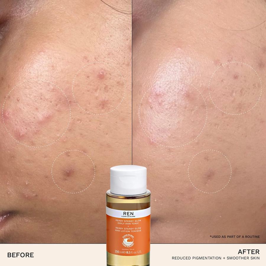REN Clean Skincare Ready Steady Glow Daily AHA Tonic 250ml