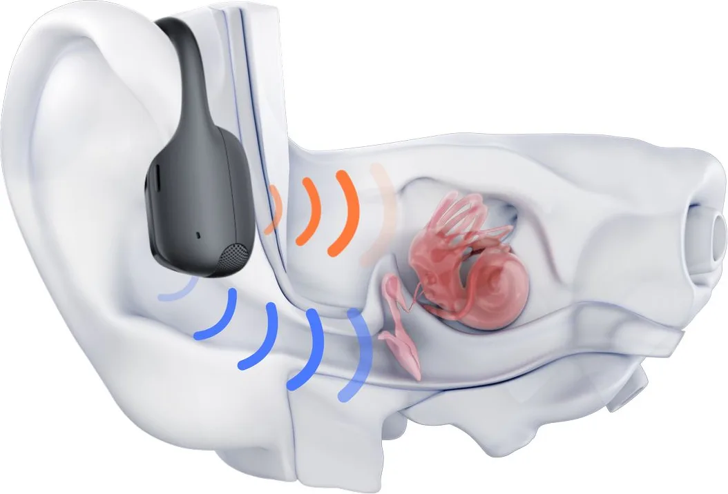 Shokz Open Run Pro 2 Noir Écouteurs Bluetooth