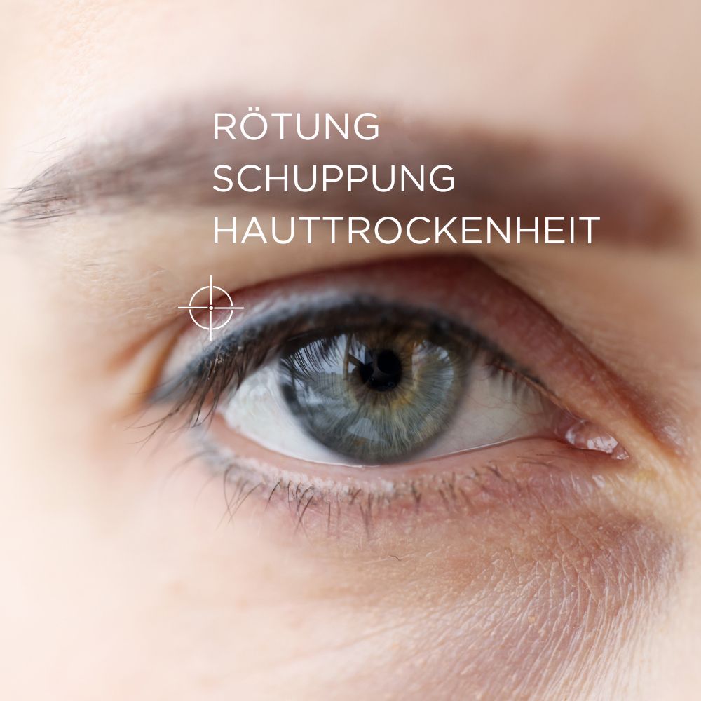 ALLERGIKA® Augenlidcreme MED - Jetzt 2 Euro sparen mit code ,,allergika2''