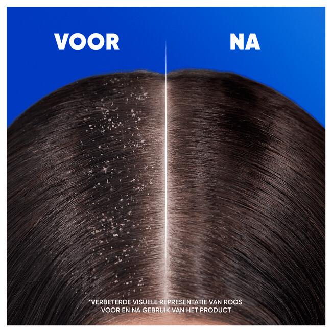 Head & Shoulders Menthol Fresh 2in1 Anti-Roos Shampoo & Conditioner 300 ML