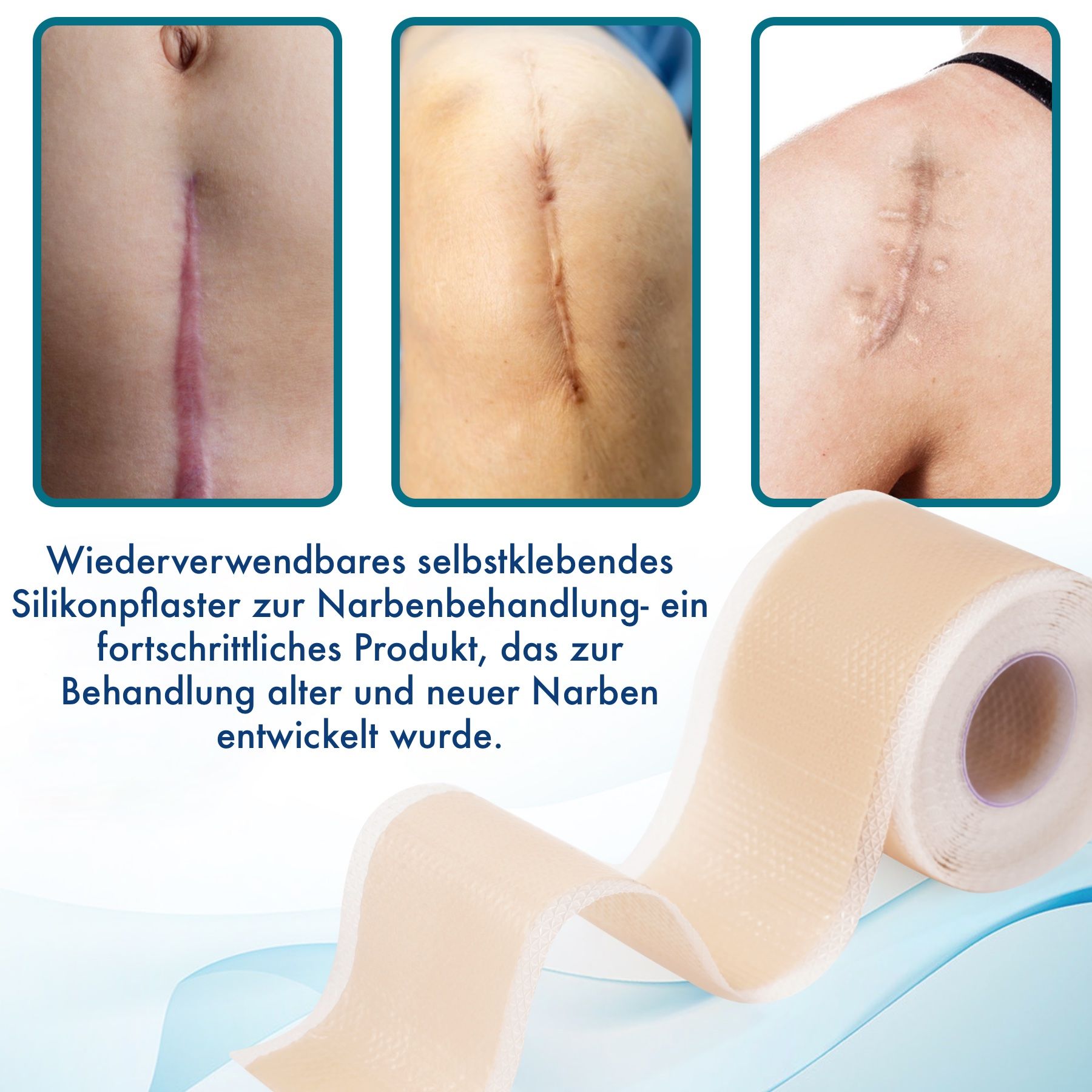P-Beauty Wundpflaster für Narben