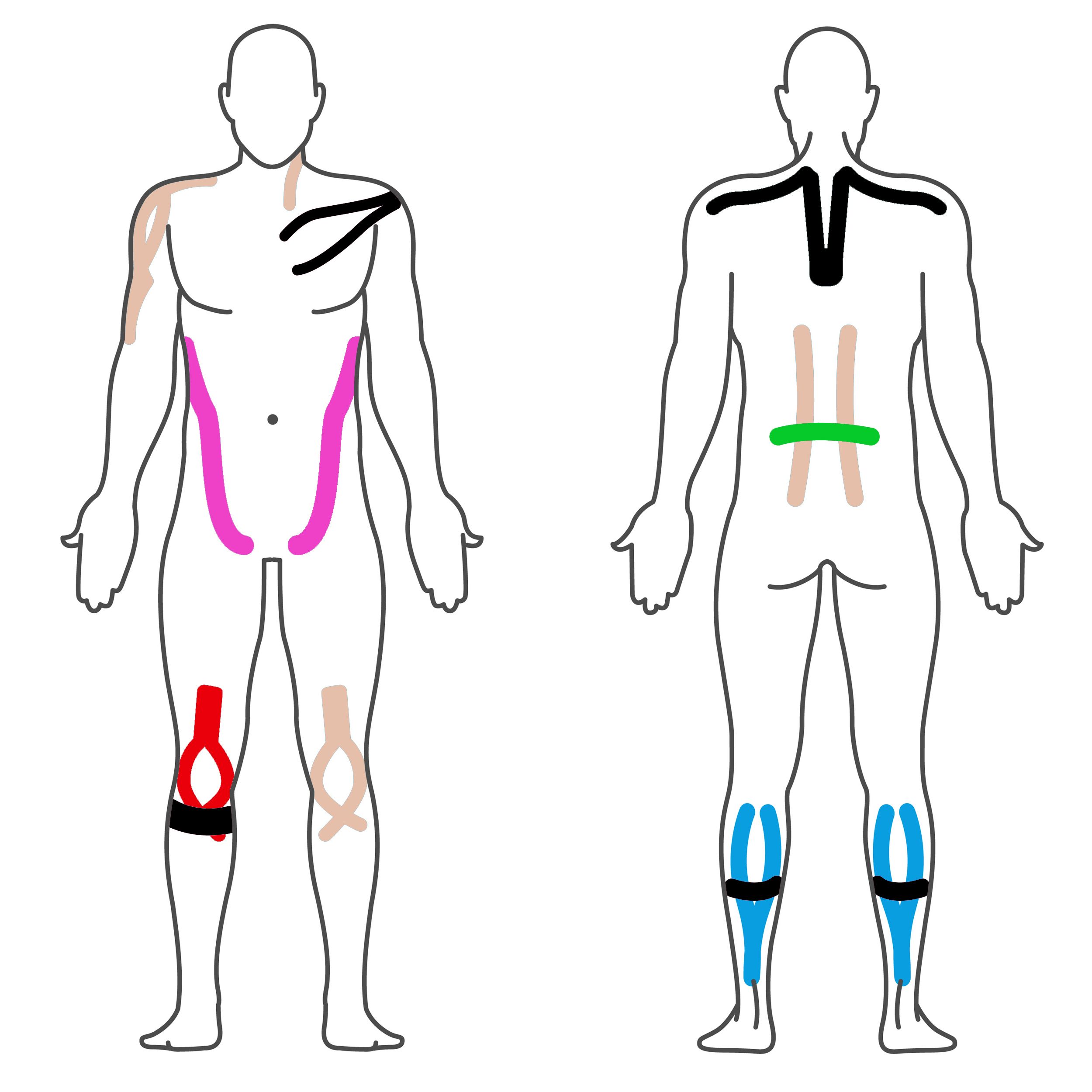 Effekt Manufaktur Kinesiologie Tape – 500 x 5 cm – in mehreren Farben - Kinesiotape