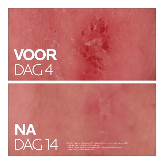 La Roche-Posay Cicaplast Balsem B5 Gevoelige Huid 40 ML