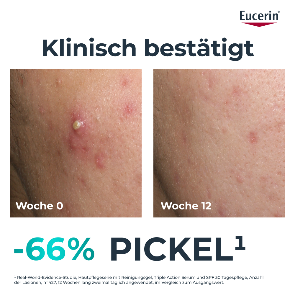 EUCERIN Dermopure Clinical Pflege<br>40 ml, 3-fach tiefenwirksam