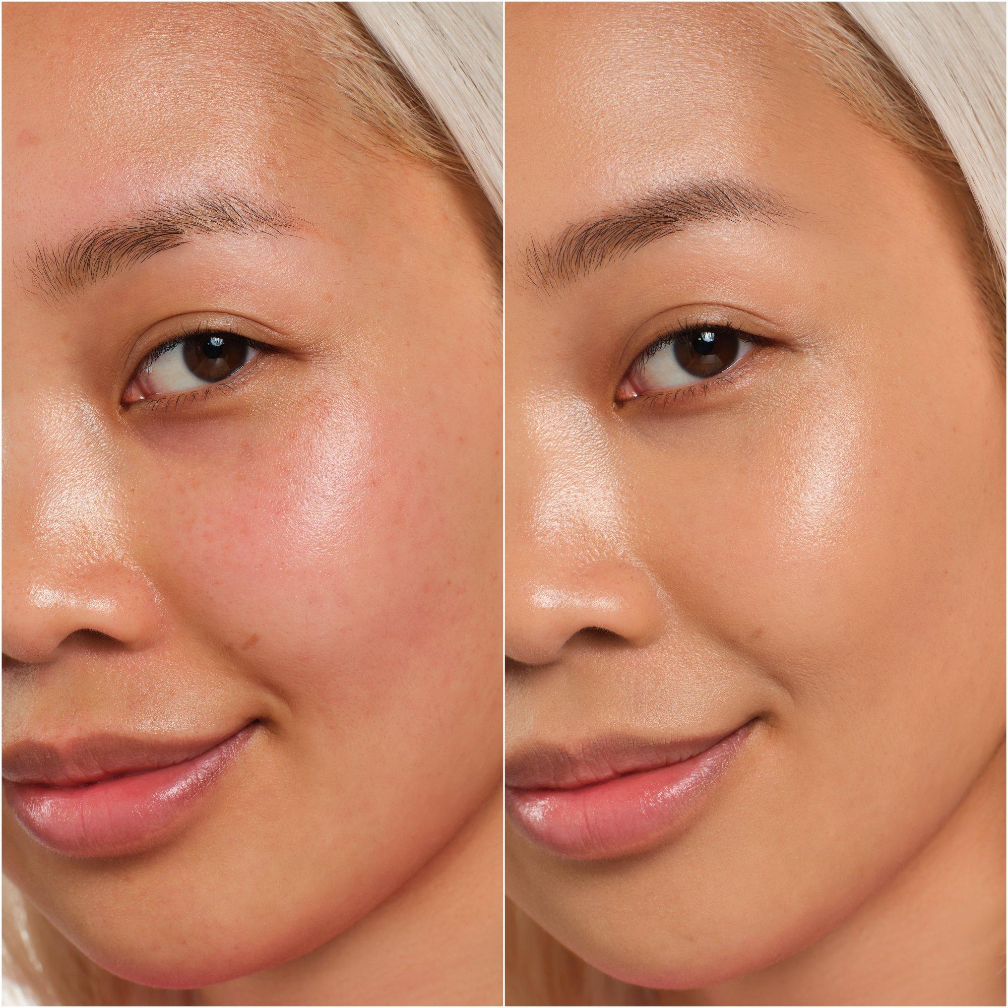 SKIN tint