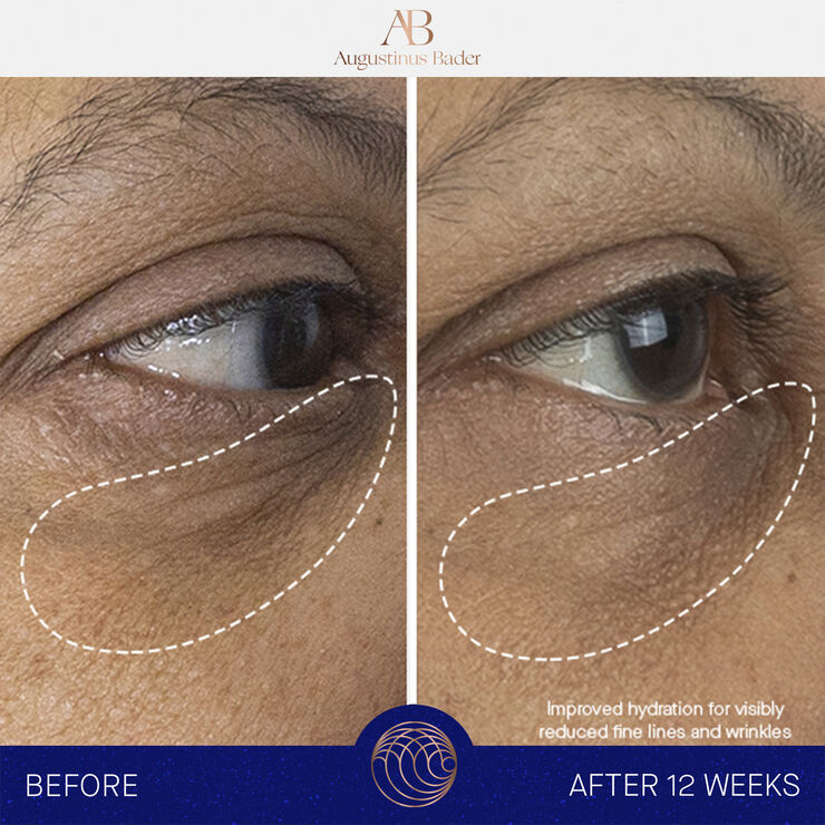 Augustinus Bader The Eye Cream