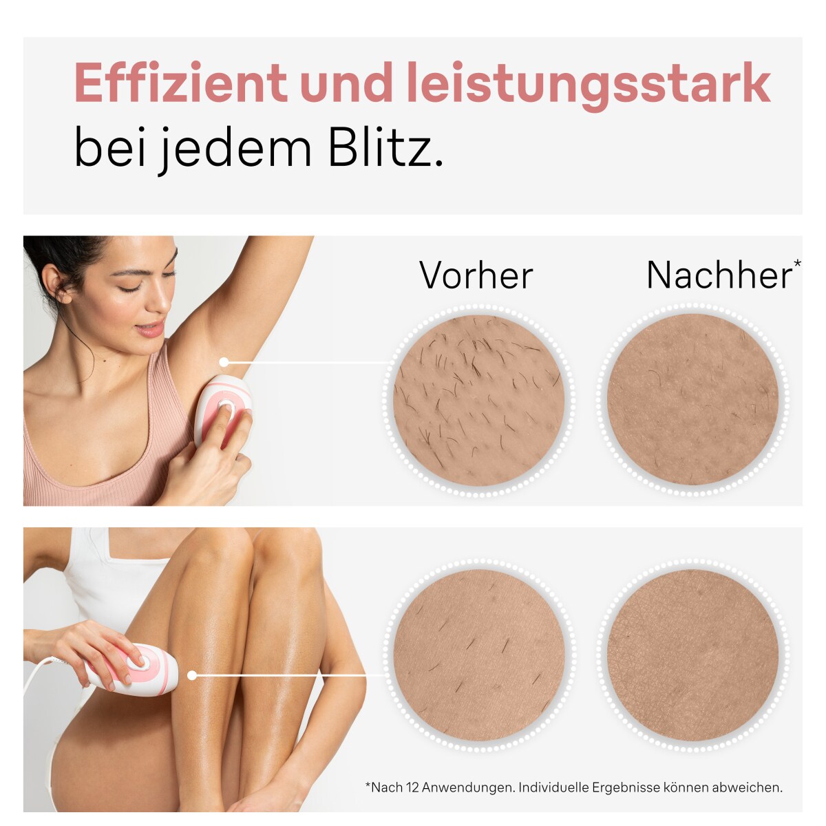 Braun Silk-expert Pro IPL PL1000 Haarentfernungsgerät