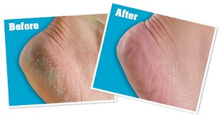 O'Keeffe's Healthy Feet Voetcreme 91GR