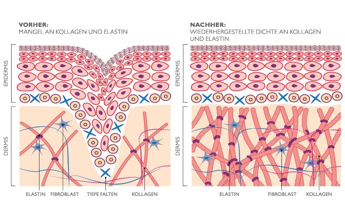 Antiaging-Gerät FaceTite Revive Cordless Weiss<br>Hautverjüngungs Gerät ohne Kabel
