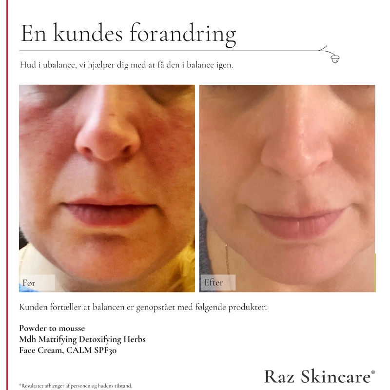 Raz Skincare Face Cream SPF 30 Calm 50 ml
