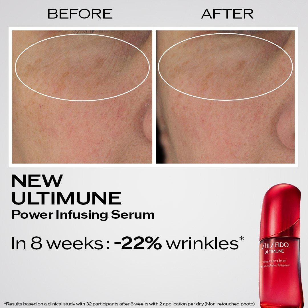 Shiseido Ultimune Power Infusing Serum<br>30 ml