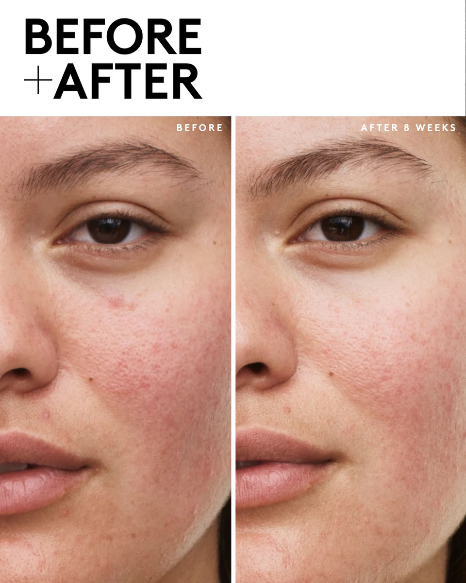 Fenty Skin Vault 5-Piece AM + PM Skincare Essentials with Mineral SPF