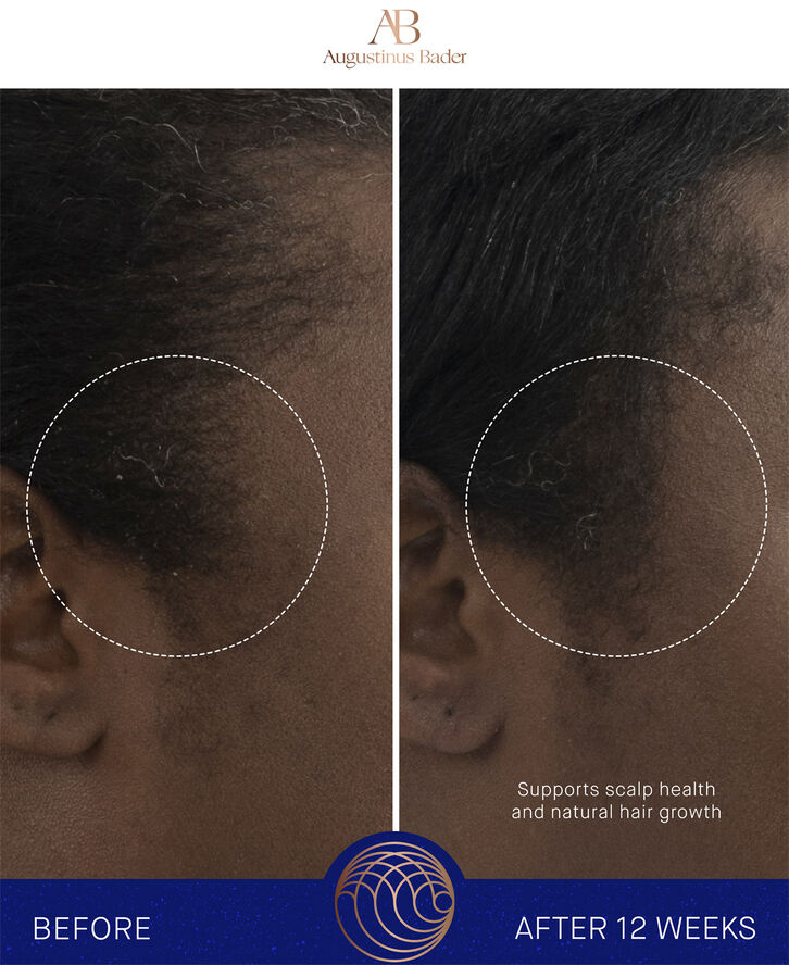 Augustinus Bader The Scalp Treatment