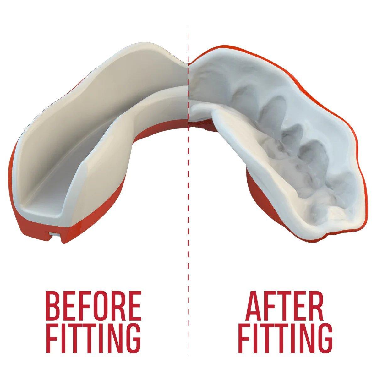 Safejawz Extro Series Viper Sports Mouthguard