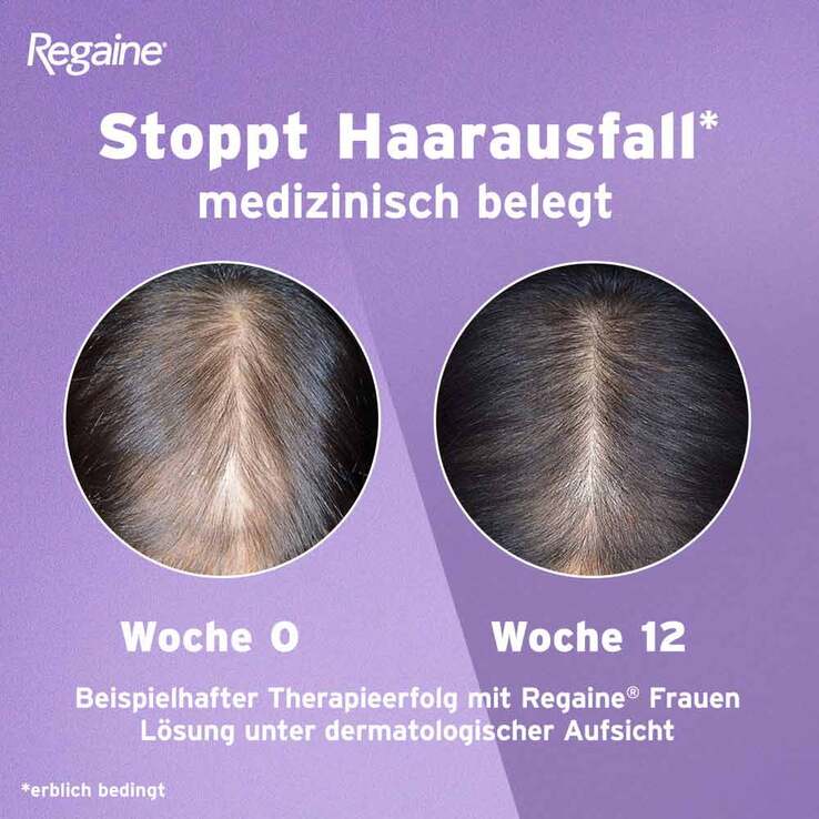 Regaine Frauen Lösung, 2x3x60 ml