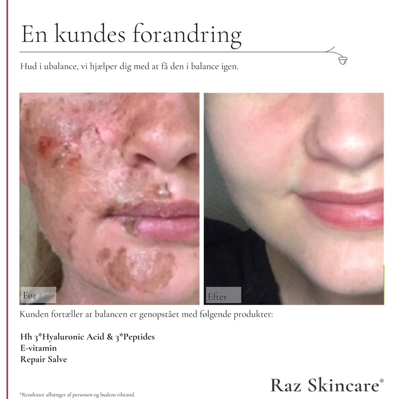 Raz Skincare Repair Perfume Free 15 ml