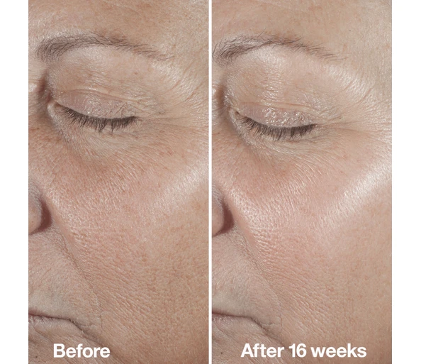 Clinique Smart Clinical Repair Wrinkle Correcting Retinol Serum
