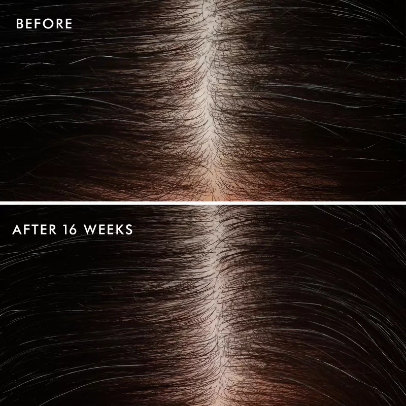Moroccanoil Revitalizing Scalp Tonic 100 ml