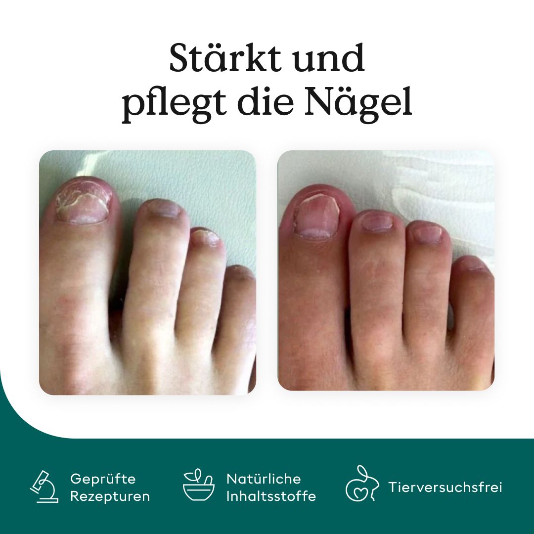 Health Routine Nail Care Pen / Pflege bei Nagelpilz