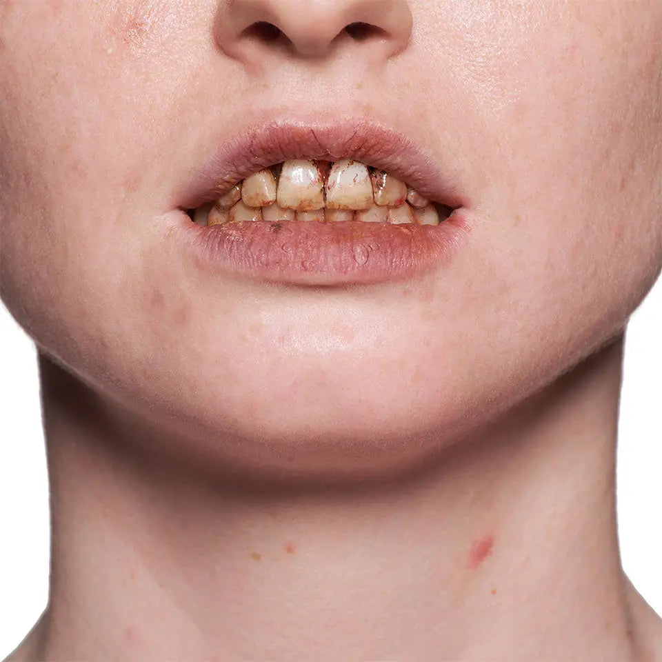 Tooth Enamel Red