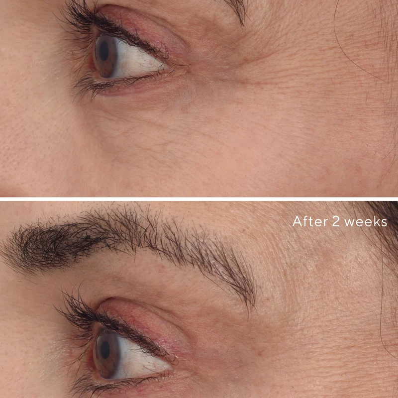 Murad Resurgence Retinal Rescuplt Eye Lift Treatment 15 ml