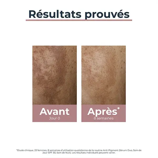 Sérum Duo Anti-Pigmentação Eucerin para Manchas Escuras 30ml