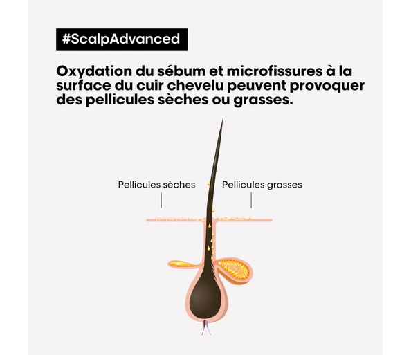 L'Oréal Professionnel Scalp Advanced Anti-Dandruff Shampoo