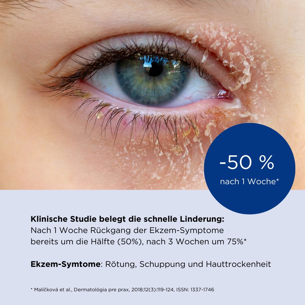 ALLERGIKA® Augenlidcreme MED - Jetzt 2 Euro sparen mit code ,,allergika2''