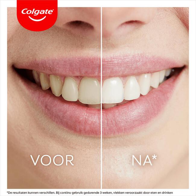 Colgate Max White Overnight Whitening Pen