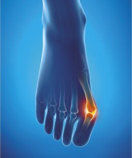 Epitact Hallux Valgus Beschermer Maat 39-41 1ST