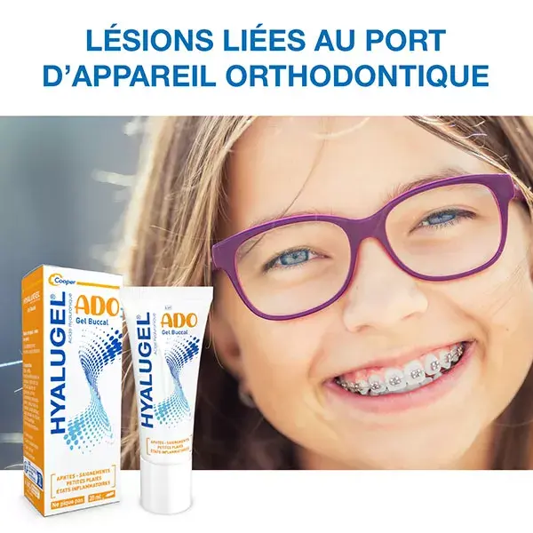 Gel oral Hyalugel para lesões, aftas, feridas menores e inflamações 20ml
