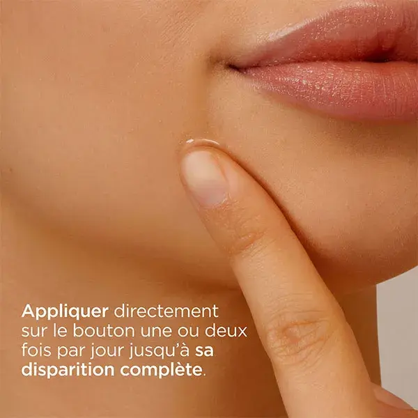 Isdin Acniben® Gel para Tratamento Local 15ml