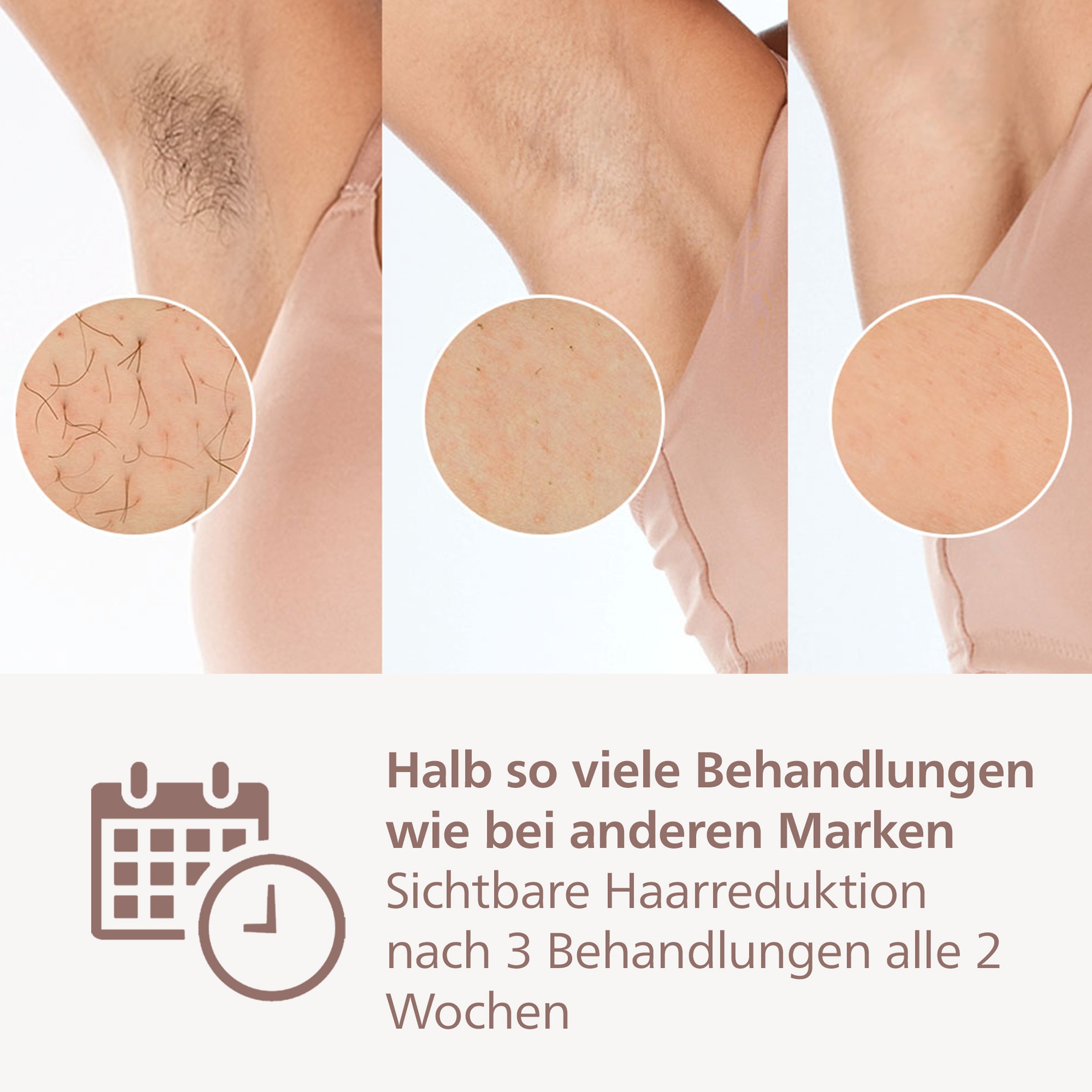 Philips IPL-Haarentferner »Lumea Series 9900« 450.000 Lichtimpulse 4 Aufsätze (Achseln, Bikinizone, Körper, Gesicht), 3 SkinAI Funktionen