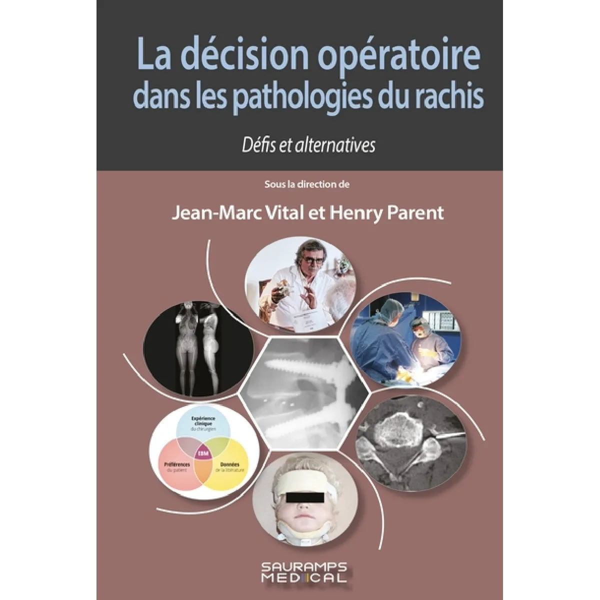 La décision opératoire dans les pathologies du rachis : défis et alternatives