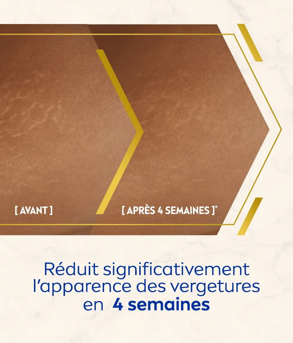 HUILE SÉRUM CORPS ANTI-VERGETURES LUMINOUS 630