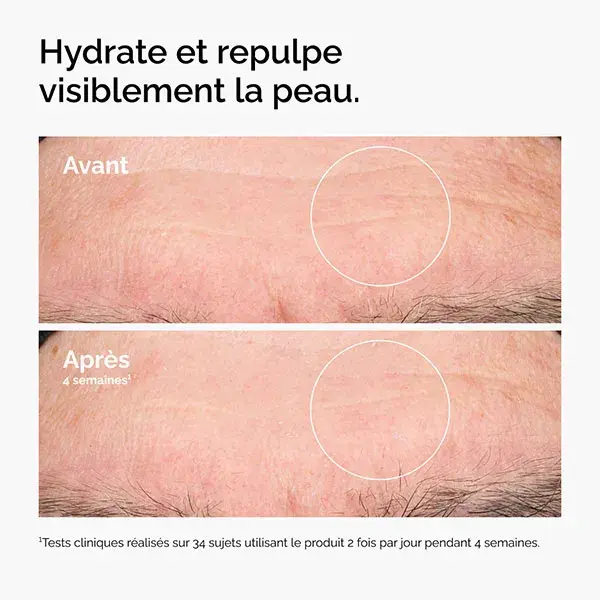 The Ordinary Ácido Hialurônico 2% + B5 30ml