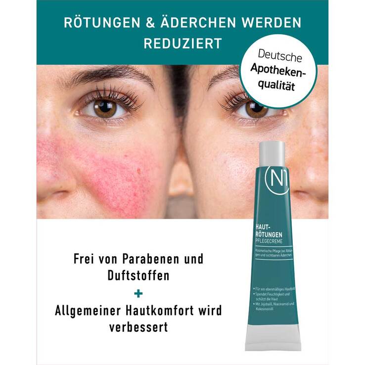 N1 Hautrötungen Pflegecreme, 30 ml