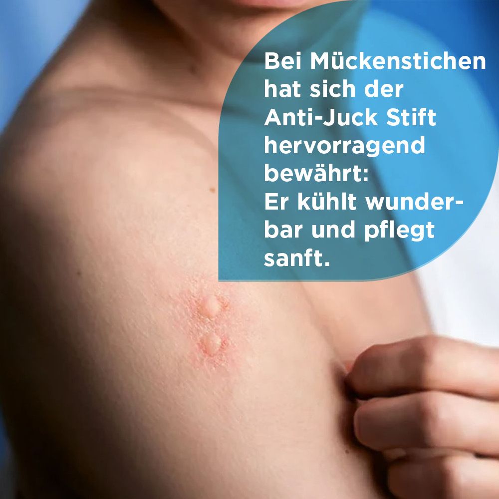 Soventol Anti-Juck Stift bei Insektenstichen