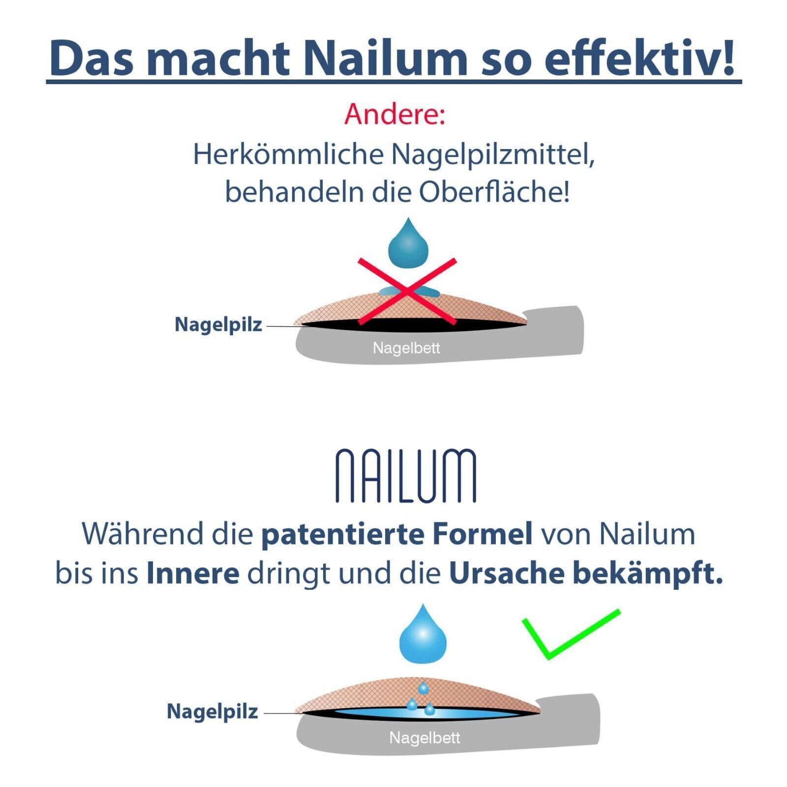 Nalium Anti Nagelpilz-Behandlungsstift