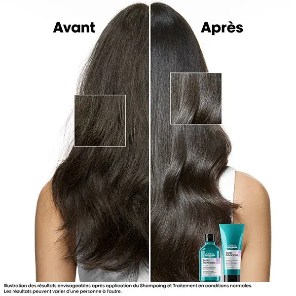 L'Oréal Professionnel Série Expert Scalp Advanced Refil Shampoo Anti-Desconforto 500ml