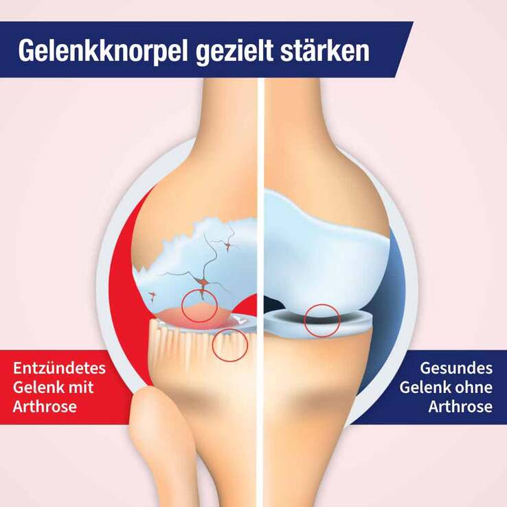 GELENCIUM® arthro Tropfen, 50 ml