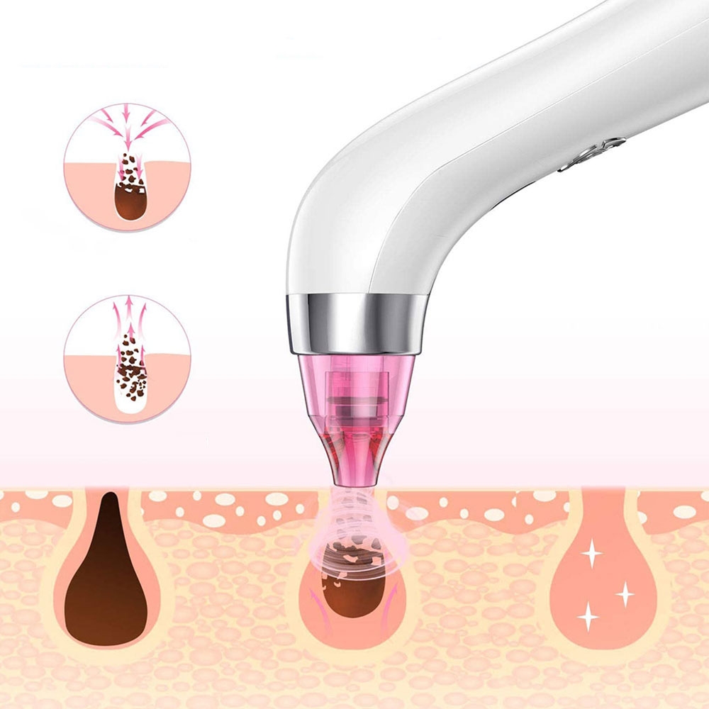 (5-tlg. Set) Elektrischer USB Gesichtsreiniger / Pflegepeeler / Mitesserentferner - Weiss / Rosa