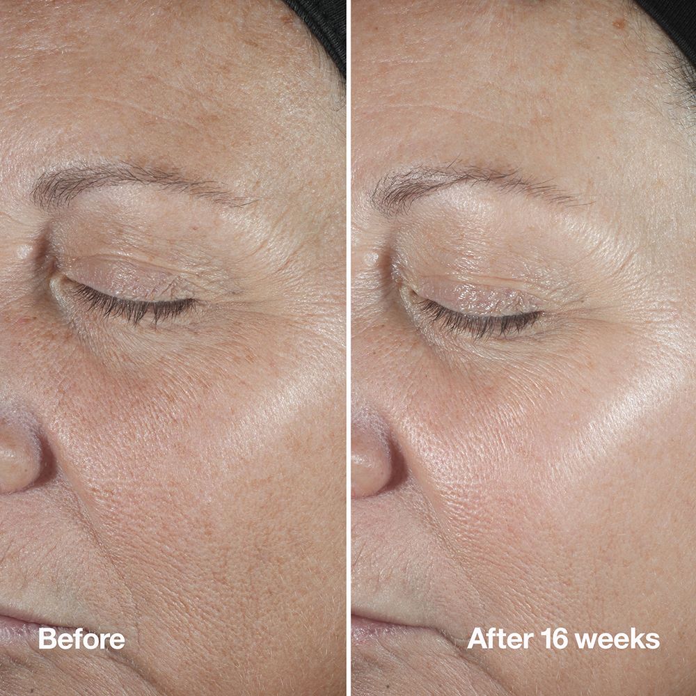 CLINIQUE Smart Clinical Repair™ Wrinkle Correcting Serum Anti-Age & Anti-Falten Feuchtigkeitspflege