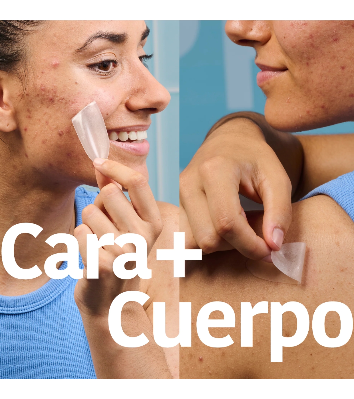Iroha Nature  - *Acne Prone Skin* - Adesivos para espinhas com ácido salicílico XL