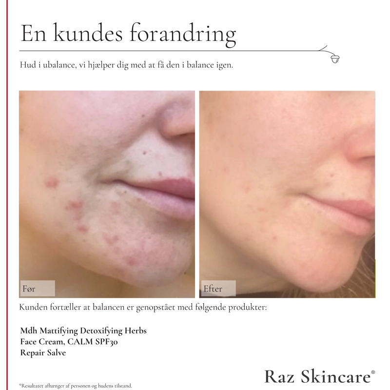Raz Skincare Repair Perfume Free 15 ml