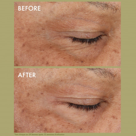 Origins Plantscription™ Crème Yeux Correction Rides au Rétinol Encapsulé
