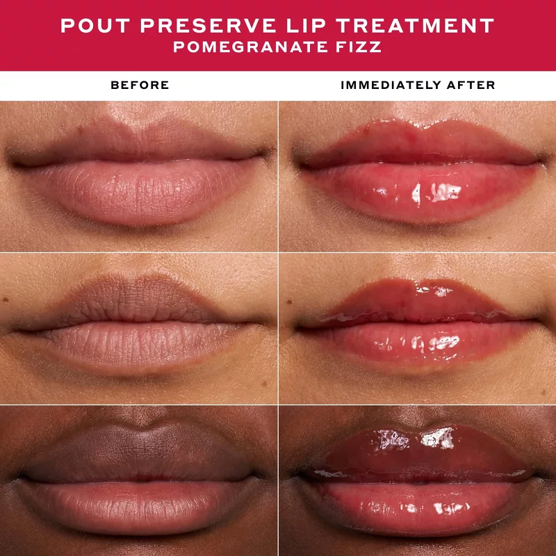 Ole Henriksen Lip Treatment Gift Set (Limited Edition)